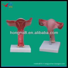 Modèle anatomique de l&#39;utérus de haute qualité, modèle reproducteur féminin